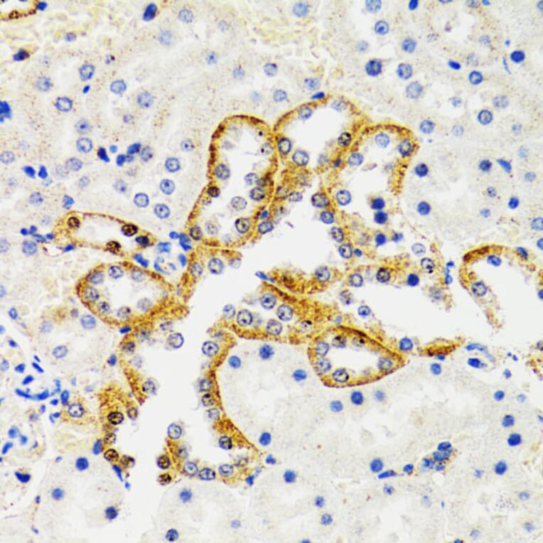Immunohistochemistry - Anti-SH2B1/PSM Antibody (A14845) - Antibodies.com