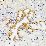 Immunohistochemistry - Anti-SH2B1/PSM Antibody (A14845) - Antibodies.com