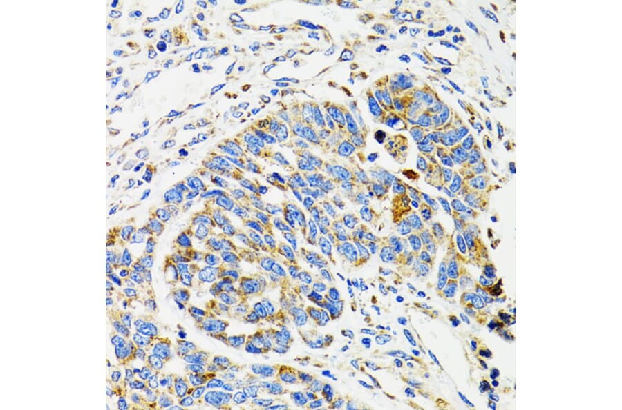 Immunohistochemistry - Anti-SH2B1/PSM Antibody (A14845) - Antibodies.com