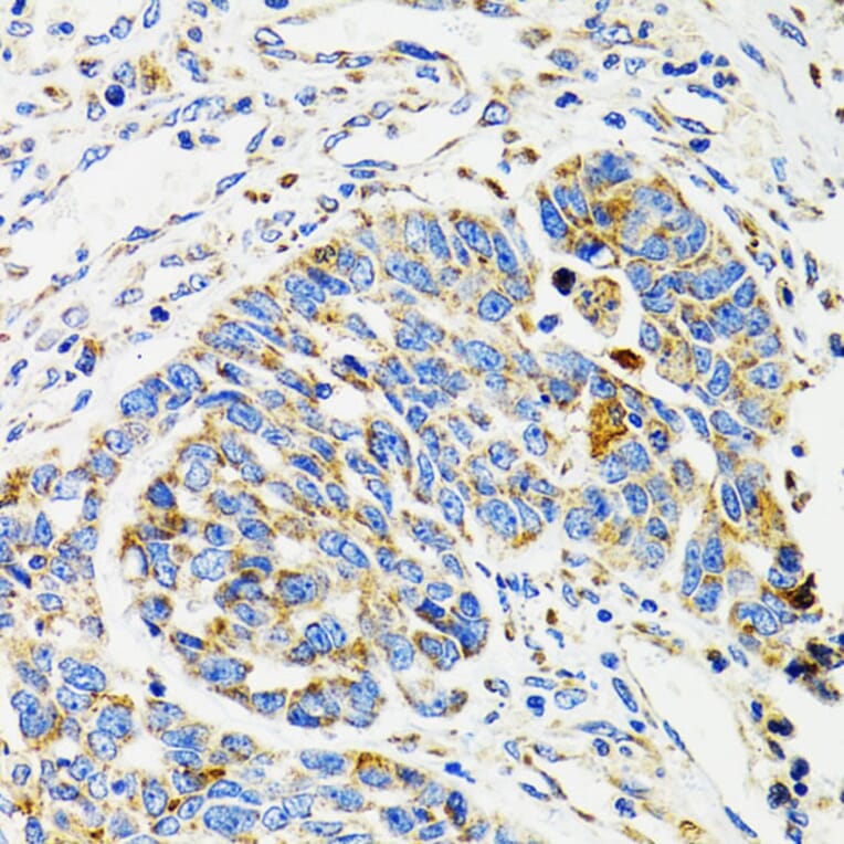 Immunohistochemistry - Anti-SH2B1/PSM Antibody (A14845) - Antibodies.com