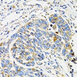 Immunohistochemistry - Anti-SH2B1/PSM Antibody (A14845) - Antibodies.com