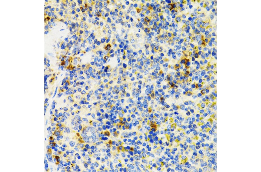 Immunohistochemistry - Anti-SH2B1/PSM Antibody (A14845) - Antibodies.com