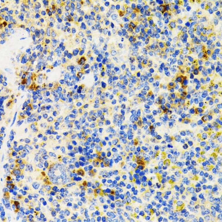 Immunohistochemistry - Anti-SH2B1/PSM Antibody (A14845) - Antibodies.com
