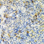 Immunohistochemistry - Anti-SH2B1/PSM Antibody (A14845) - Antibodies.com