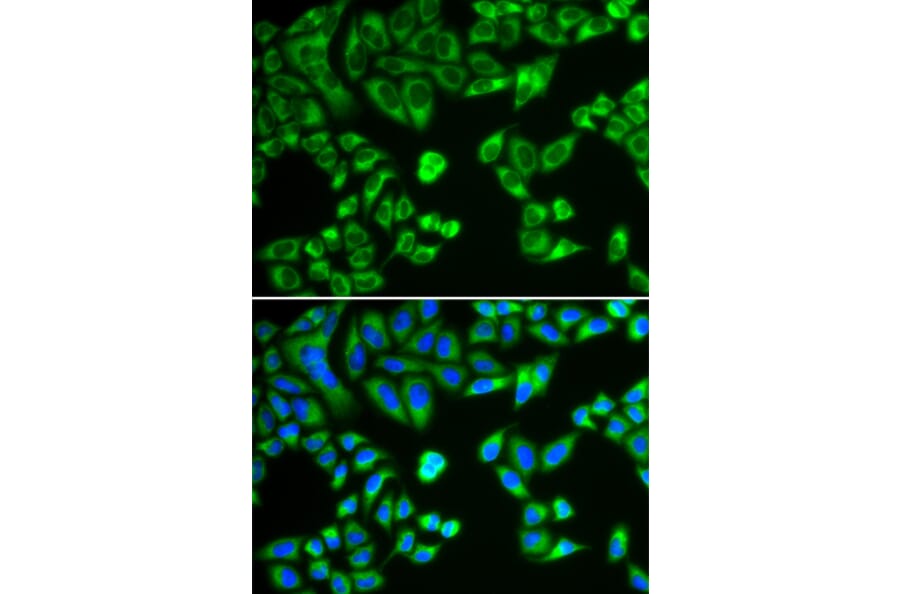 Immunofluorescence - Anti-SH2B1/PSM Antibody (A14845) - Antibodies.com