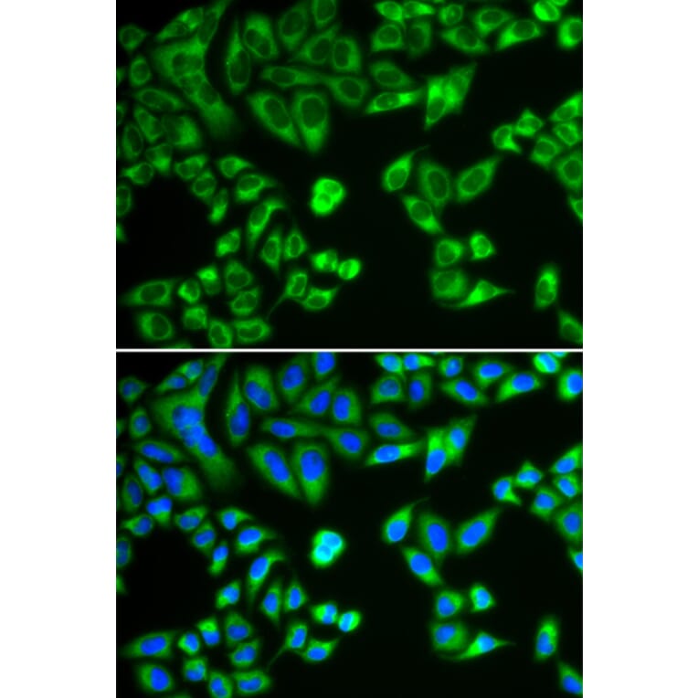 Immunofluorescence - Anti-SH2B1/PSM Antibody (A14845) - Antibodies.com