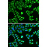 Immunofluorescence - Anti-SH2B1/PSM Antibody (A14845) - Antibodies.com