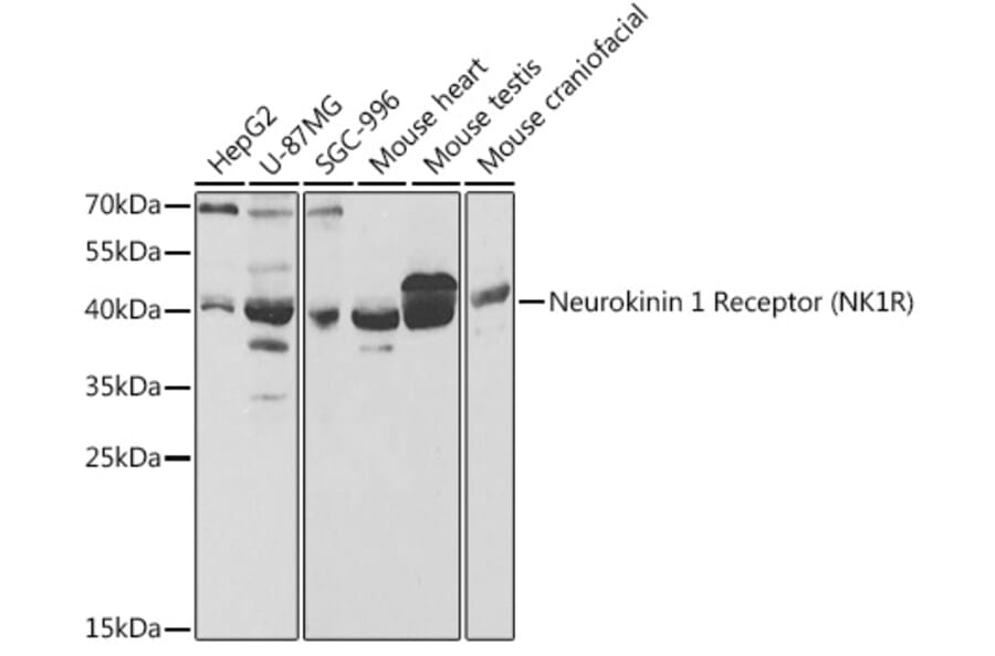 Western Blot - Anti-NK-1R Antibody (A14846) - Antibodies.com