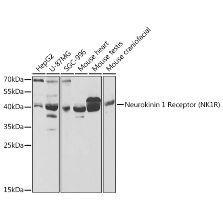 Western Blot - Anti-NK-1R Antibody (A14846) - Antibodies.com