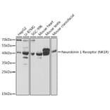 Western Blot - Anti-NK-1R Antibody (A14846) - Antibodies.com