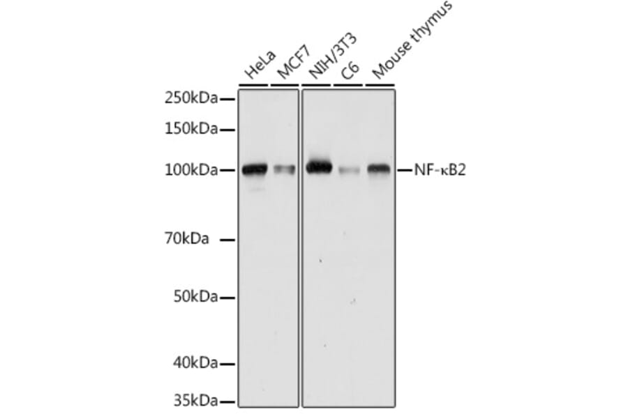 Western Blot - Anti-NFkB p100 / NFKB2 Antibody (A14847) - Antibodies.com