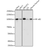 Western Blot - Anti-NFkB p100 / NFKB2 Antibody (A14847) - Antibodies.com