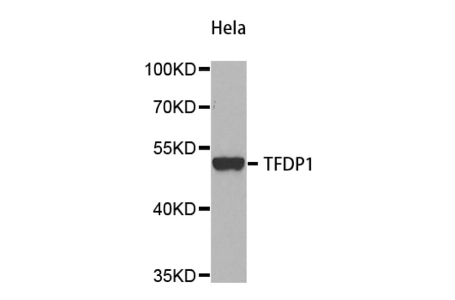 Western Blot - Anti-TFDP1 Antibody (A5569) - Antibodies.com