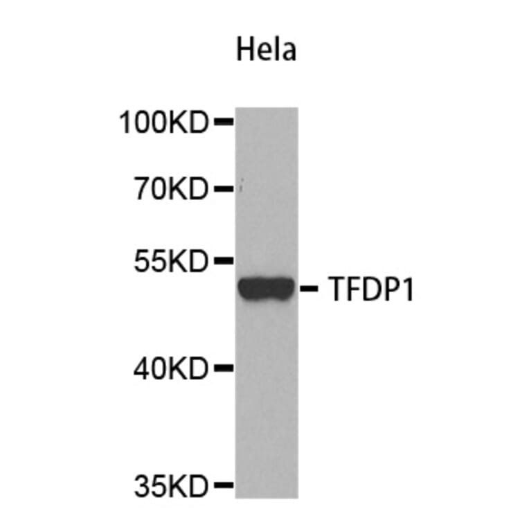 Western Blot - Anti-TFDP1 Antibody (A5569) - Antibodies.com
