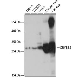 Western Blot - Anti-CRYBB2 Antibody (A14850) - Antibodies.com