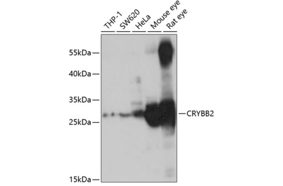 Western Blot - Anti-CRYBB2 Antibody (A14850) - Antibodies.com