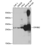 Western Blot - Anti-CRYBB2 Antibody (A14850) - Antibodies.com