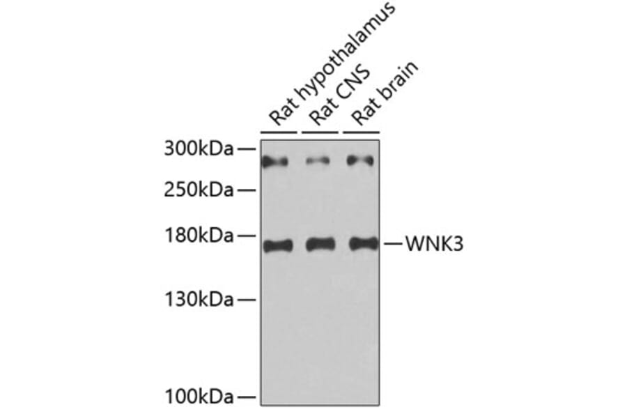 Western Blot - Anti-WNK3 Antibody (A5574) - Antibodies.com