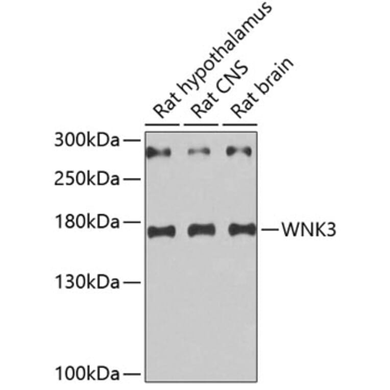 Western Blot - Anti-WNK3 Antibody (A5574) - Antibodies.com