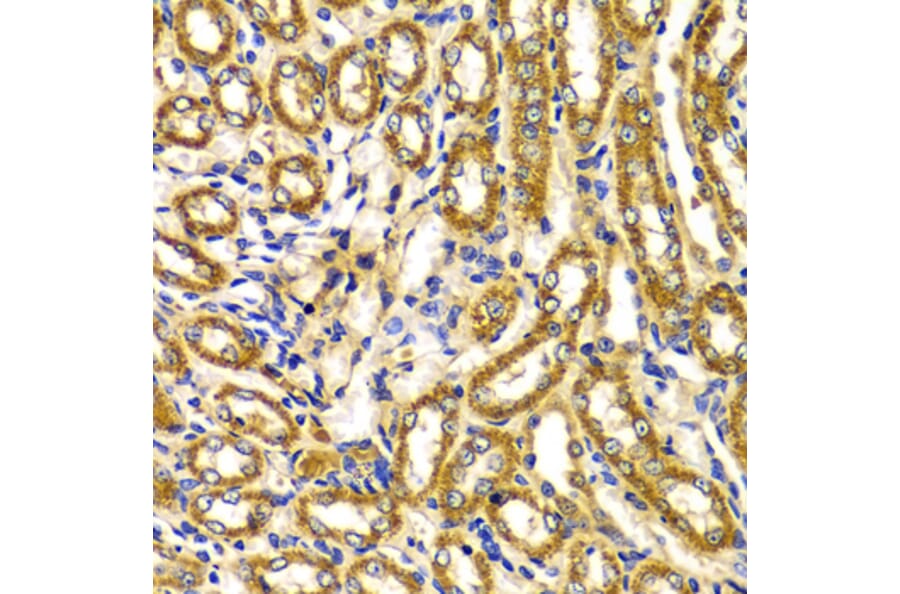 Immunohistochemistry - Anti-WNK3 Antibody (A5574) - Antibodies.com