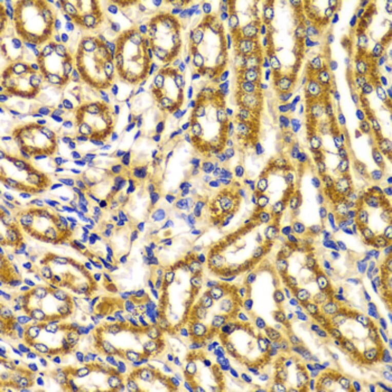 Immunohistochemistry - Anti-WNK3 Antibody (A5574) - Antibodies.com