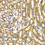 Immunohistochemistry - Anti-WNK3 Antibody (A5574) - Antibodies.com