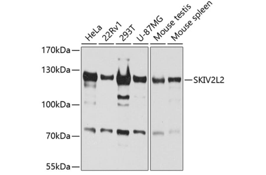 Western Blot - Anti-MTR4 Antibody (A14853) - Antibodies.com