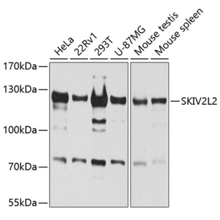 Western Blot - Anti-MTR4 Antibody (A14853) - Antibodies.com