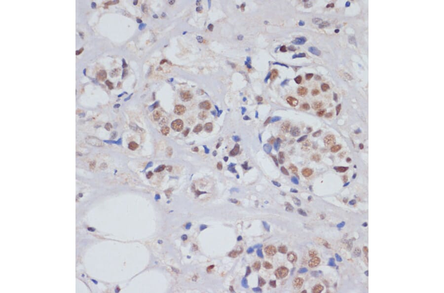 Immunohistochemistry - Anti-MTR4 Antibody (A14853) - Antibodies.com