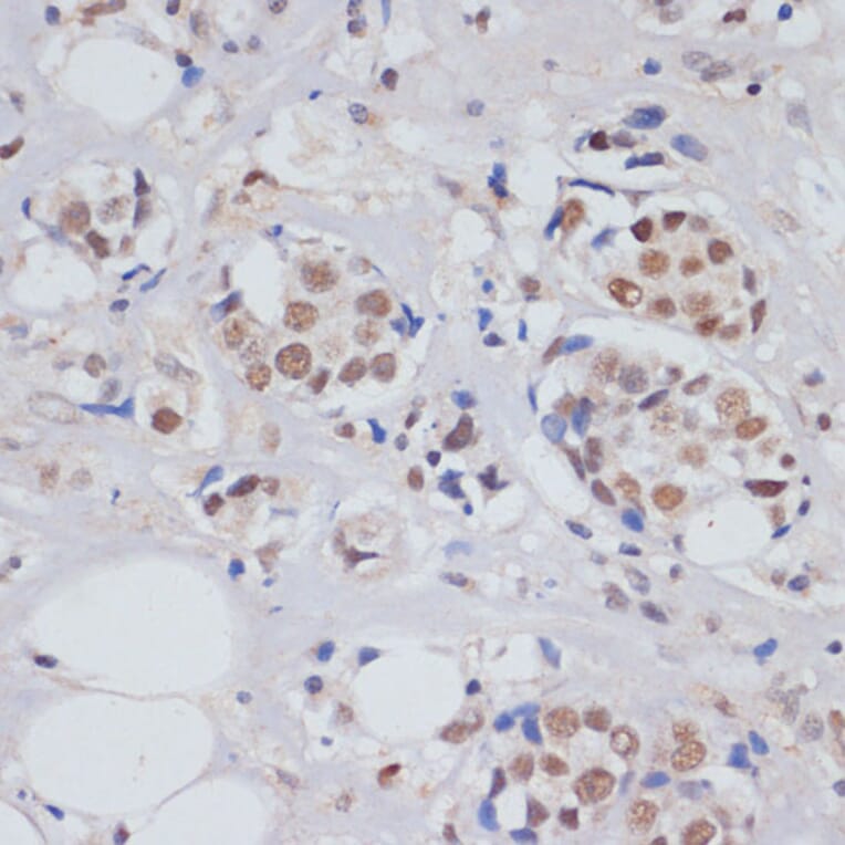 Immunohistochemistry - Anti-MTR4 Antibody (A14853) - Antibodies.com