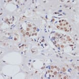 Immunohistochemistry - Anti-MTR4 Antibody (A14853) - Antibodies.com