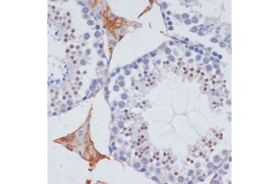 Immunohistochemistry - Anti-MTR4 Antibody (A14853) - Antibodies.com
