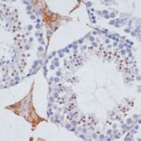 Immunohistochemistry - Anti-MTR4 Antibody (A14853) - Antibodies.com