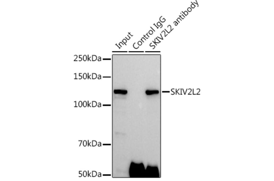Western Blot - Anti-MTR4 Antibody (A14853) - Antibodies.com