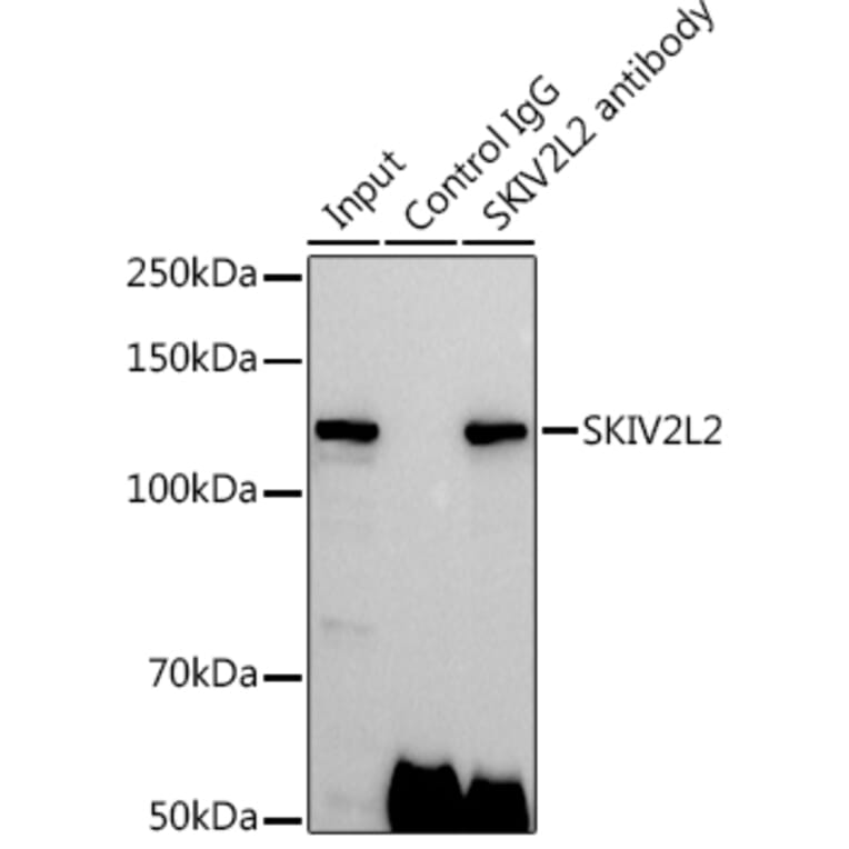 Western Blot - Anti-MTR4 Antibody (A14853) - Antibodies.com