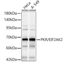 Western Blot - Anti-PKR Antibody (A14854) - Antibodies.com