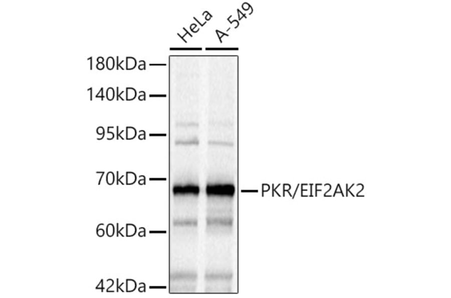 Western Blot - Anti-PKR Antibody (A14854) - Antibodies.com