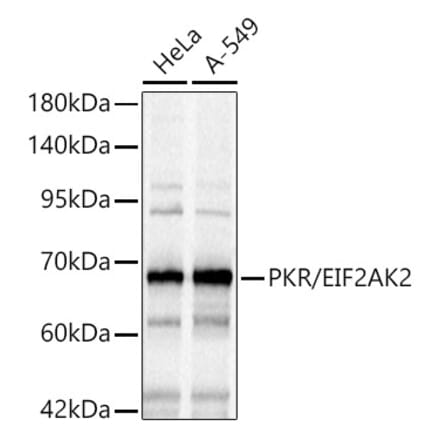 Western Blot - Anti-PKR Antibody (A14854) - Antibodies.com