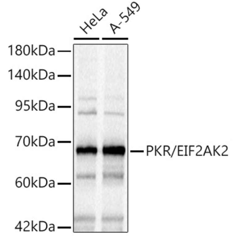 Western Blot - Anti-PKR Antibody (A14854) - Antibodies.com