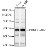 Western Blot - Anti-PKR Antibody (A14854) - Antibodies.com