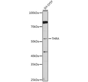 Western Blot - Anti-Thyroid Hormone Receptor alpha Antibody (A14855) - Antibodies.com