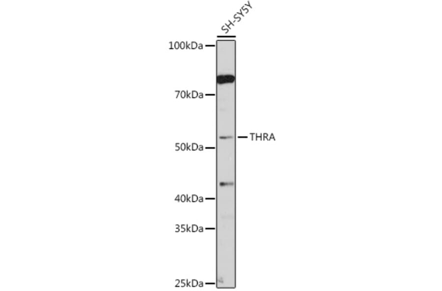 Western Blot - Anti-Thyroid Hormone Receptor alpha Antibody (A14855) - Antibodies.com