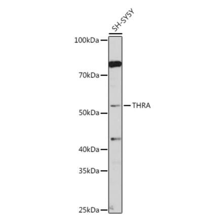 Western Blot - Anti-Thyroid Hormone Receptor alpha Antibody (A14855) - Antibodies.com