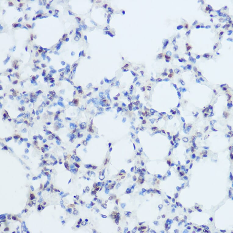 Immunohistochemistry - Anti-Thyroid Hormone Receptor alpha Antibody (A14855) - Antibodies.com