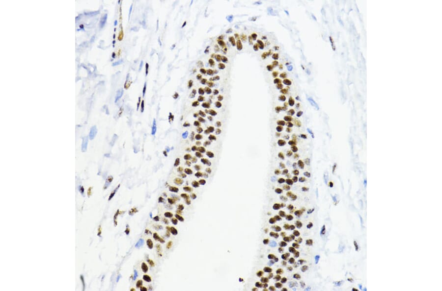 Immunohistochemistry - Anti-ZEB1 Antibody (A14856) - Antibodies.com