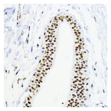 Immunohistochemistry - Anti-ZEB1 Antibody (A14856) - Antibodies.com