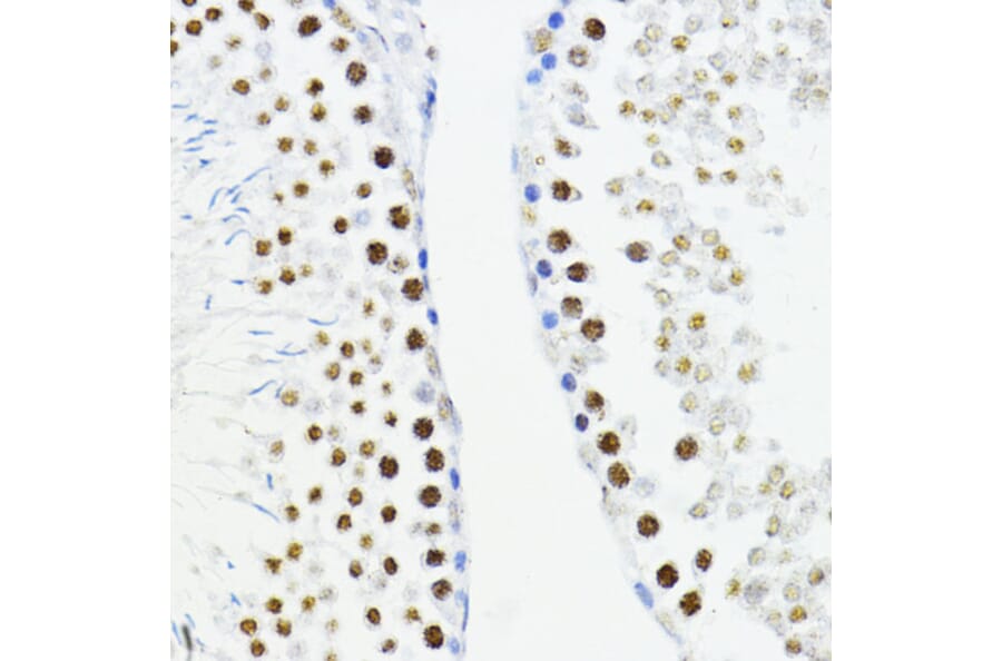 Immunohistochemistry - Anti-ZEB1 Antibody (A14856) - Antibodies.com