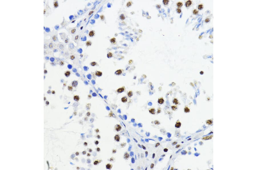 Immunohistochemistry - Anti-ZEB1 Antibody (A14856) - Antibodies.com