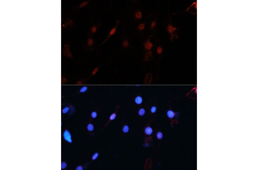 Immunofluorescence - Anti-ZEB1 Antibody (A14856) - Antibodies.com