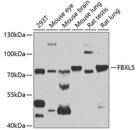 Western Blot - Anti-FBXL5 Antibody (A14857) - Antibodies.com